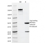 SDS-PAGE analysis of purified, BSA-free Vimentin antibody (clone VM452) as confirmation of integrity and purity.