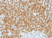 IHC testing of FFPE human lymph node with TCL1 antibody (clone TLLP1-1). HIER: boil tissue sections in pH 9 10mM Tris with 1mM EDTA for 10-20 min followed by cooling at RT for 20 min.