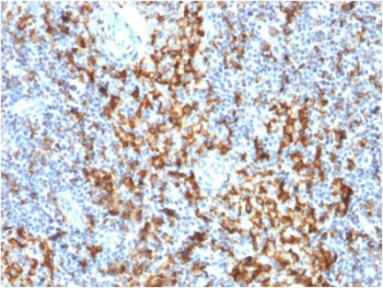 IHC testing of FFPE human lymph node with CD163 antibody (clone M130/1210). HIER: boil tissue sections in pH6, 10mM citrate buffer, for 10-20 min followed by cooling at RT for 20 min.~