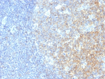 IHC testing of human tonsil with CD40 antibody (clone C40/2383). Required HIER: boil tissue sections in 10mM citrate buffer, pH 6, for 10-20 min.~