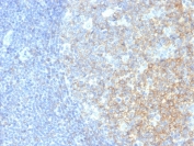 IHC testing of human tonsil with CD40 antibody (clone C40/2383). HIER: boil tissue sections in pH9 EDTA for 10-20 min.