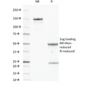 SDS-PAGE analysis of purified, BSA-free CD40 antibody (clone C40/2383) as confirmation of integrity and purity.