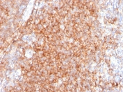 IHC testing of human tonsil with CD40 antibody (clone C40/2383). HIER: boil tissue sections in 10mM citrate buffer, pH 6, for 10-20 min.