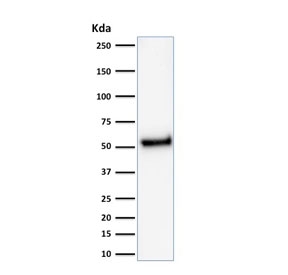 Western blot testing of human HeLa cell lysate with recombinant p53 antibody (clone rTP53/1739). Expetected molecular weight ~53 kDa.~
