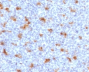 IHC staining of FFPE human tonsil with CD68 antibody (clone CDLA68-2). HIER: boil tissue sections in pH6, 10mM citrate buffer, for 10-20 min followed by cooling at RT for 20 min.