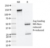SDS-PAGE analysis of purified, BSA-free TPSAB1 antibody (clone TPSAB1/1961) as confirmation of integrity and purity.