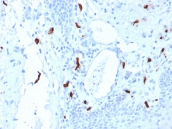 IHC testing of FFPE human tonsil tissue with TPSAB1 antibody (clone TPSAB1/1961). HIER: boil tissue sections in pH6, 10mM citrate buffer, for 10-20 min followed by cooling at RT for 20 min.~