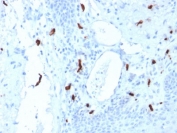 IHC testing of FFPE human tonsil tissue with TPSAB1 antibody (clone TPSAB1/1961). HIER: boil tissue sections in pH6, 10mM citrate buffer, for 10-20 min followed by cooling at RT for 20 min.