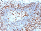 IHC testing of FFPE human lymph node with ZAP70 antibody (clone ZAP70/2046). HIER: boil tissue sections in pH 9 10mM Tris with 1mM EDTA for 10-20 min followed by cooling at RT for 20 min.