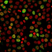 Immunofluorescent staining of PFA-fixed human Jurkat cells with ZAP70 antibody (green, clone ZAP70/2047) and Reddot nuclear stain (red).