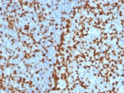 IHC testing of FFPE human tonsil with ZAP70 antibody (clone ZAP70/2047). HIER: boil tissue sections in pH 9 10mM Tris with 1mM EDTA for 10-20 min followed by cooling at RT for 20 min.