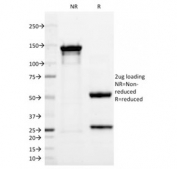 SDS-PAGE analysis of purified, BSA-free p63 antibody (clone TP63/2428) as confirmation of integrity and purity.