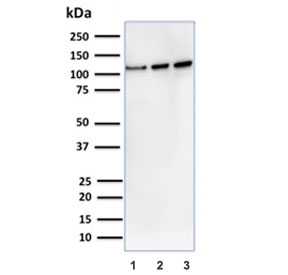 Western blot testing of 1) human A431, 2) human K562 and 3) mouse NIH 3T3 cell lysate with Vinculin antibody. Predicted molecular weight ~124 kDa.