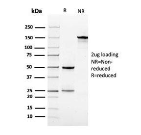 SDS-PAGE analysis of purified, BSA-free Vinculin antibody (clone VCL/2575) as confirmation of integrity and purity.