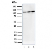 Western blot testing of 1) human A431, 2) human K562 and 3) mouse NIH 3T3 cell lysate with Vinculin antibody. Predicted molecular weight ~124 kDa.