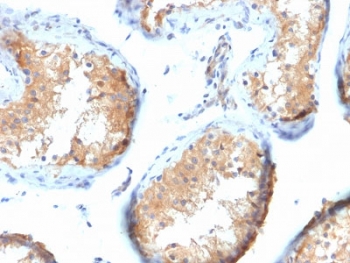 IHC testing of FFPE human testis tissue with Vinculin antibody (clone VCL/2573). HIER: boil tissue sections in pH6, 10mM citrate buffer, for 10-20 min followed by cooling at RT for 20 min.~