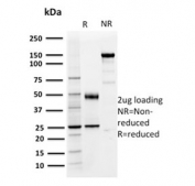 SDS-PAGE analysis of purified, BSA-free PD-L1 antibody (clone PDL1/2746) as confirmation of integrity and purity.