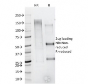 SDS-PAGE analysis of purified, BSA-free CD79b antibody (clone IGB/1844) as confirmation of integrity and purity.