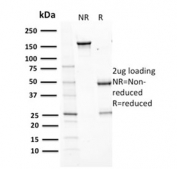 SDS-PAGE analysis of purified, BSA-free Aurora B antibody (clone AURKB/1593) as confirmation of integrity and purity.