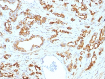 IHC testing of FFPE human prostate tissue with Aurora B antibody (clone AURKB/1593). HIER: boil tissue sections in pH6, 10mM citrate buffer, for 10-20 min followed by cooling at RT for 20 min.~