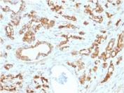 IHC testing of FFPE human prostate tissue with Aurora B antibody (clone AURKB/1593). HIER: boil tissue sections in pH6, 10mM citrate buffer, for 10-20 min followed by cooling at RT for 20 min.