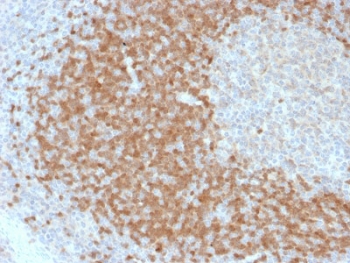 IHC testing of FFPE human lymph node with TCL1 antibod