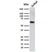 Western blot testing of human Jurkat cell lysate with CD5 antibody (clone CD5/2416). Observed molecular weight: 55~67 kDa depending on glycosylation level.