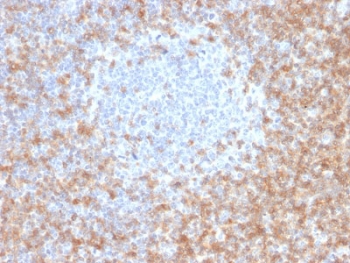 IHC staining of FFPE human tonsil with CD5 antibody (clone CD5/2416). Required HIER: boil tissue sections in 10mM citrate buffer, pH 6, for 10-20 min followed by cooling at RT for 20 min.~