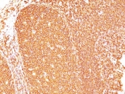 IHC staining of FFPE human tonsil tissue with CD45 antibody. HIER: boil tissue sections in pH 9 10mM Tris with 1mM EDTA for 20 min and allow to cool before testing.
