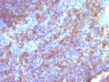 IHC staining of FFPE human tonsil tissue with CD45 antibody. HIER: boil tissue sections in pH 9 10mM Tris with 1mM EDTA for 20 min and allow to cool before testing.