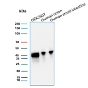 CDX2 Antibody Human/Cell Line WB. Western blot analysis of CDX2 / Caudal type homeobox 2 expression using CDX2 antibody, clone CDX2/2951R. Lane 1: HEK293T cell lysate, Lane 2: human colon tissue lysate, Lane 3: human small intestine tissue lysate. A band is detected at approximately 40 kDa, consistent with the predicted molecular weight of CDX2, with stronger signal observed in intestinal tissues compared to HEK293T cells, aligning with the known epithelial and gastrointestinal-restricted expression pattern of this transcription factor.