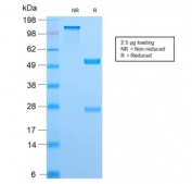 SDS-PAGE analysis of purified, BSA-free recombinant TOP1MT antibody (clone TOP1MT/2883R) as confirmation of integrity and purity.