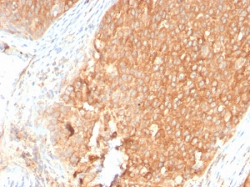 IHC staining of FFPE human pancreas with recombinant TOP1MT antibody. HIER: boil tissue sections in pH 9 10mM Tris with 1mM EDTA for 10-20 min and allow to cool before testing.~
