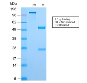 SDS-PAGE analysis of purified, BSA-free recombinant TOP1MT