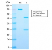 SDS-PAGE analysis of purified, BSA-free recombinant Adipophilin antibody (clone ADFP/2755R) as confirmation of integrity and purity.
