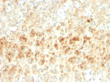 IHC testing of FFPE human adrenal tissue with recombinant Adipophilin antibody (clone ADFP/2755R). Required HIER: steam sections in pH6, 10mM citrate buffer for 10-20 min.~