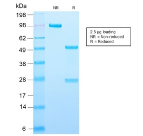 SDS-PAGE analysis of purified, BSA-free recombinant Adipophilin