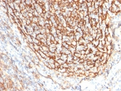 IHC testing of FFPE human tonsil tissue with CD21 antibody (clone CR2/2754). HIER: boil tissue sections in pH6, 10mM citrate buffer, for 10-20 min followed by cooling at RT for 20 min.