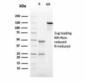 SDS-PAGE analysis of purified, BSA-free CD21 antibody (clone CR2/2754) as confirmation of integrity and purity.