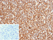 IHC testing of FFPE human tonsil tissue with CD21 antibody (clone CR2/2754). Inset: PBS used in place of primary Ab (secondary Ab negative control). HIER: boil tissue sections in pH 9 10mM Tris with 1mM EDTA for 20 min and allow to cool before testing.