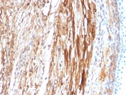 IHC staining of FFPE rat heart tissue with CRYAB antibody (clone CPTC-CRYAB-1). HIER: boil tissue sections in pH6, 10mM citrate buffer, for 10-20 min and allow to cool before testing.