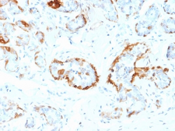 IHC staining of FFPE human breast tissue with CRYAB antibody (clone CPTC-CRYAB-1). HIER: boil tissue sections in pH6, 10mM citrate buffer, for 10-20 min and allow to cool before testing.~