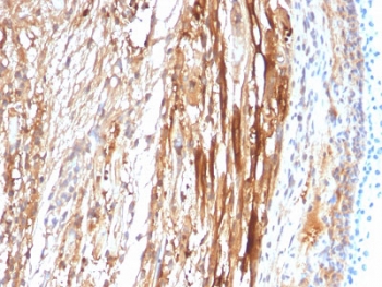 IHC staining of FFPE rat heart tissue with CRYAB
