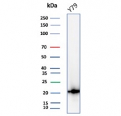 Western blot testing of human Y79 cell lysate with CRYAB antibody (clone CPTC-CRYAB-1). Predicted molecular weight: ~20 kDa.