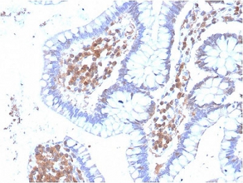 IHC testing of FFPE human colon stained with MAPK14 antibody. Required HIER: boiling tissue sections in 10mM citrate buffer, pH6, for 10-20 min followed by cooling at RT for 20 min.