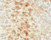 IHC testing of FFPE human adrenal tissue with recombinant Perilipin 2 antibody (clone ADPN1-2R). Required HIER: steam sections in pH6, 10mM citrate buffer for 10-20 min.