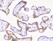IHC testing of FFPE human placental tissue with recombinant MMP3 antibody (clone MXMP3-1R). Required HIER: boil tissue sections in pH 9 10mM Tris with 1mM EDTA for 10-20 min followed by cooling at RT for 20 min.