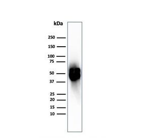 Western blot testing of human spleen tissue with recombinant Thymidine Phosphorylase antibody. Predicted molecular weight ~55 kDa.~