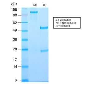 SDS-PAGE analysis of purified, BSA-free recombinant Thymidine Phosphorylase antibody (clone TYMP/2890R) a