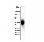 Western blot testing of human spleen tissue with recombinant Thymidine Phosphorylase antibody. Predicted molecular weight ~55 kDa.